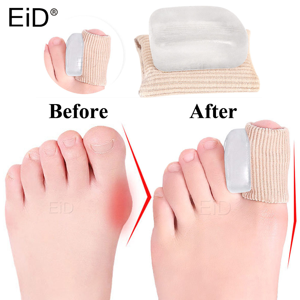 Toe Separator Silicon - Corrector de pulgar de Gel de
