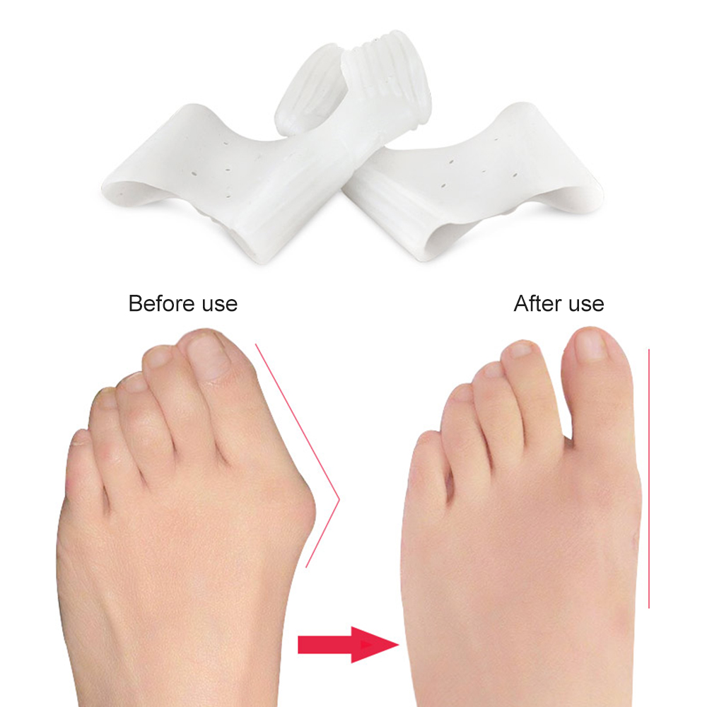 1 Par de Correctores de Juanet - Toe Separator Silicon reseña y precio