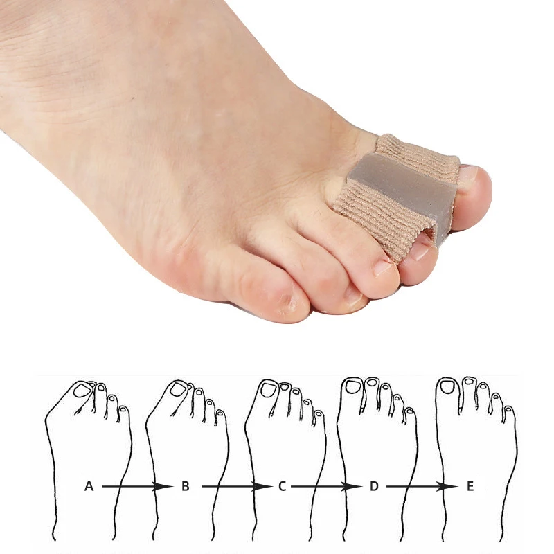 Nuevo Separador de Dedos, Corr - Toe Separator Silicon reseña y precio